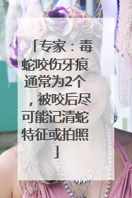 专家：毒蛇咬伤牙痕通常为2个，被咬后尽可能记清蛇特征或拍照