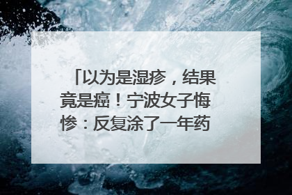 以为是湿疹，结果竟是癌！宁波女子悔惨：反复涂了一年药膏都没好！很多患者首诊都去了皮肤科