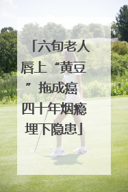 六旬老人唇上“黄豆”拖成癌 四十年烟瘾埋下隐患