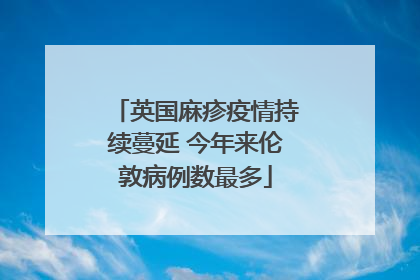 英国麻疹疫情持续蔓延 今年来伦敦病例数最多